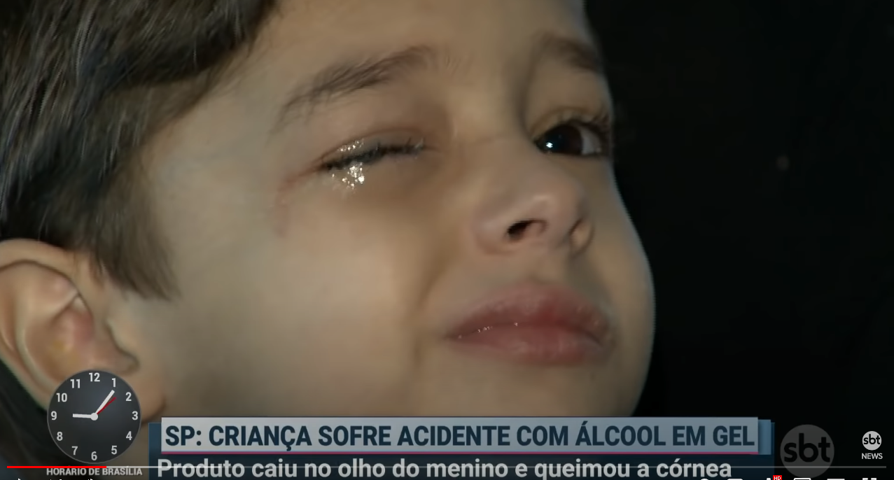Menino de cinco anos tem a córnea queimada em acidente com álcool gel